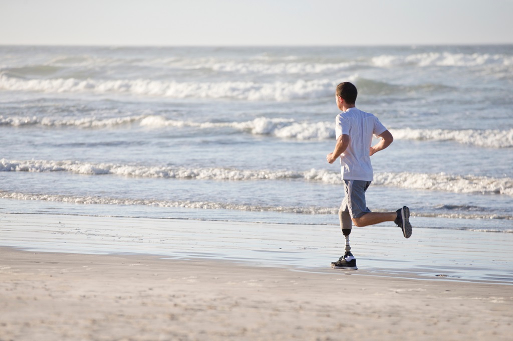 Is a Prosthetic Worth It? Can You Walk Normally with a Prosthetic Leg?